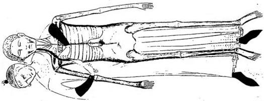 ANATOMICAL NOMENCLATURE OF THE HUMAN BODY