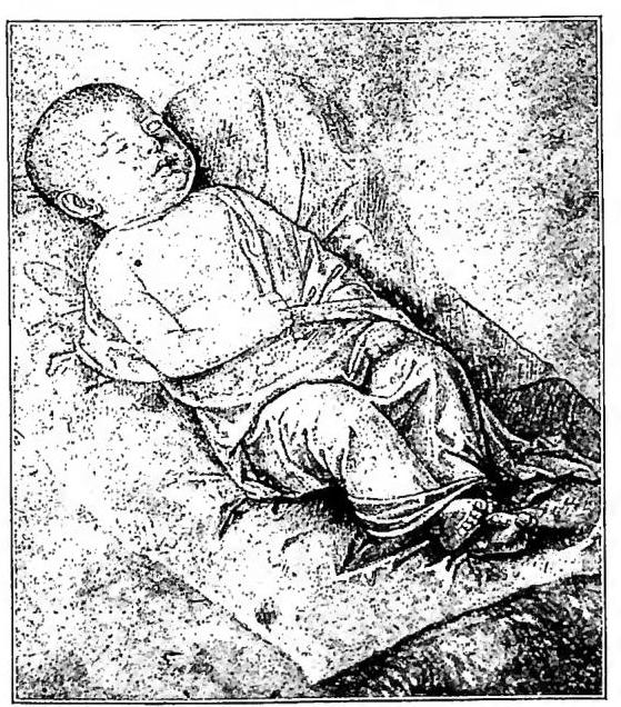 Article illustration